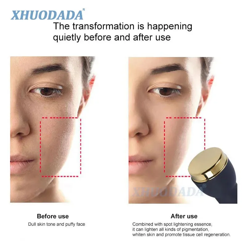 3 In 1 Ultrasonic Facial Machine Spot Tattoo Removal Anti Aging High Frequency Micro Plasma Freckle Removal Pen Beauty Device